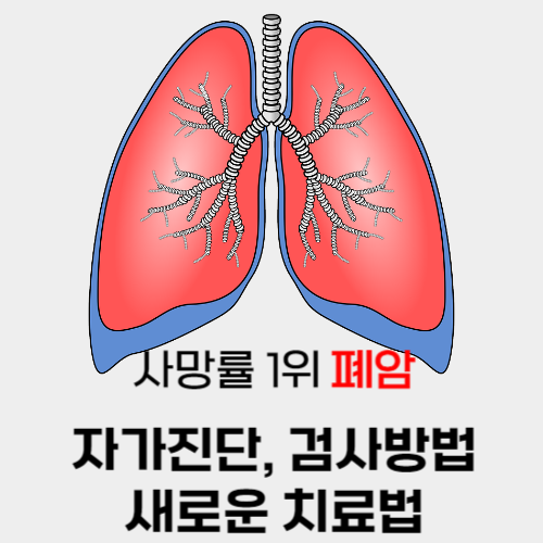 폐암 자가진단, 검사방법, 새로운 치료법 알아보기