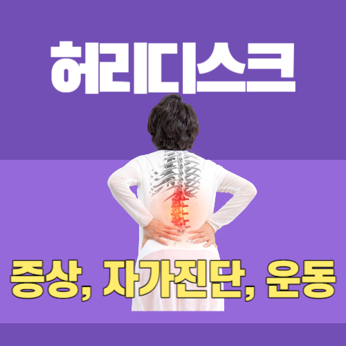 허리디스크 증상, 자가진단, 운동법