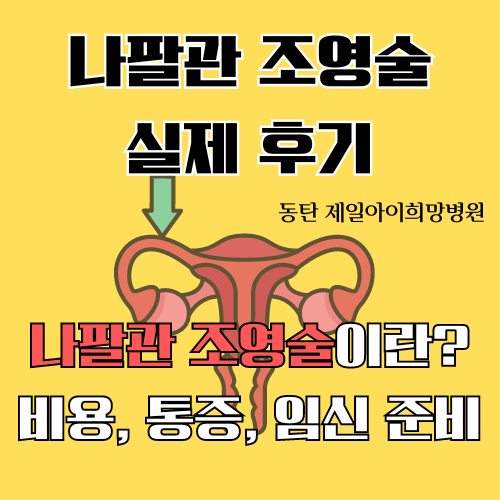 동탄제일병원 나팔관 조영술 후기